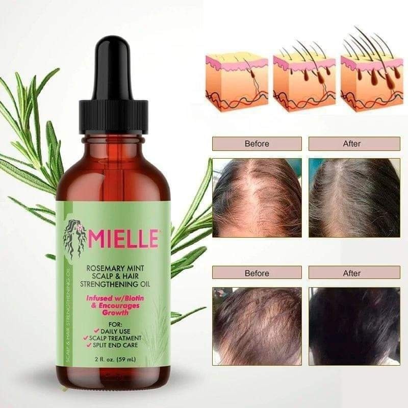 Huile croissance capillaire(Rosemary Mint)